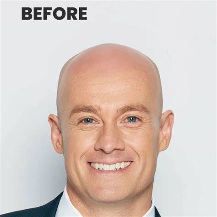 Grant Denyer